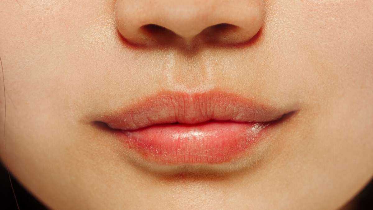 5 natural remedies for treating chapped lips during winters