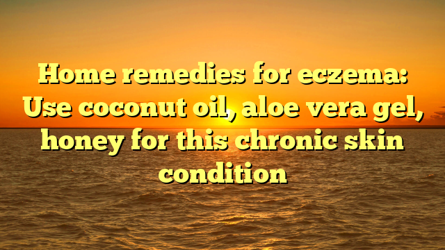 Home remedies for eczema: Use coconut oil, aloe vera gel, honey for this chronic skin condition