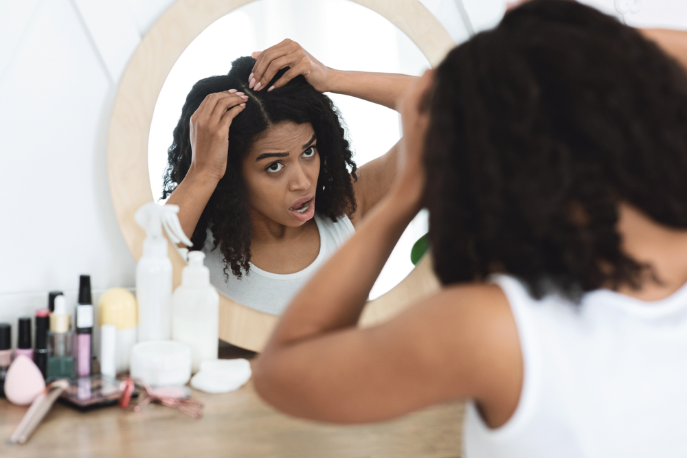 5 natural remedies for getting rid of dandruff